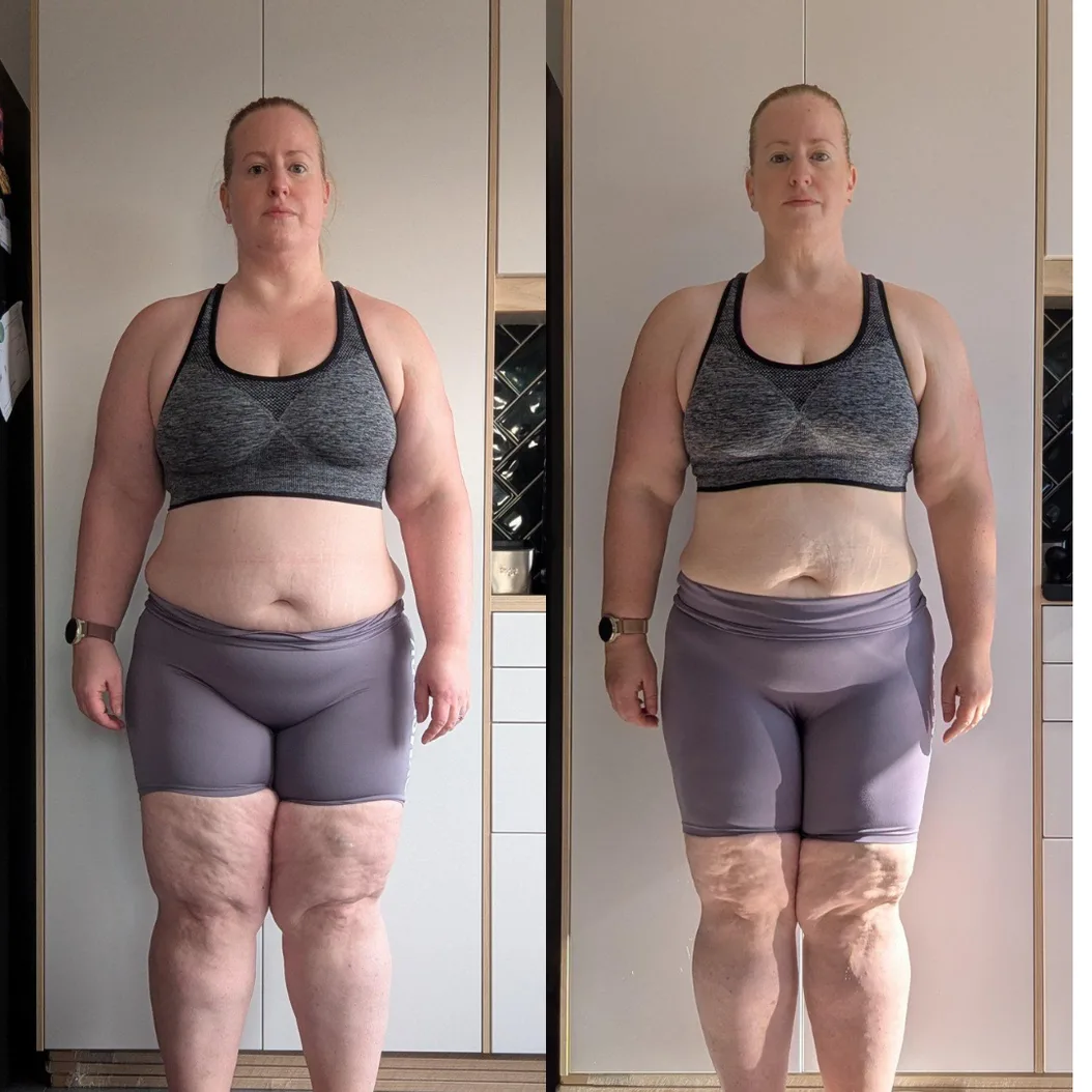 Laura — before and after transformation